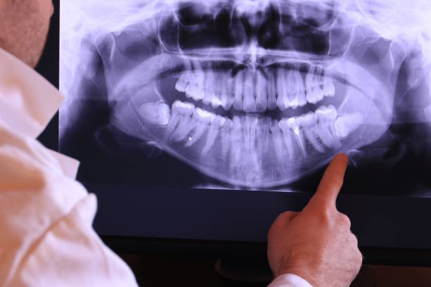Best Emergency TMJ Treatment in Agler Beach, FL